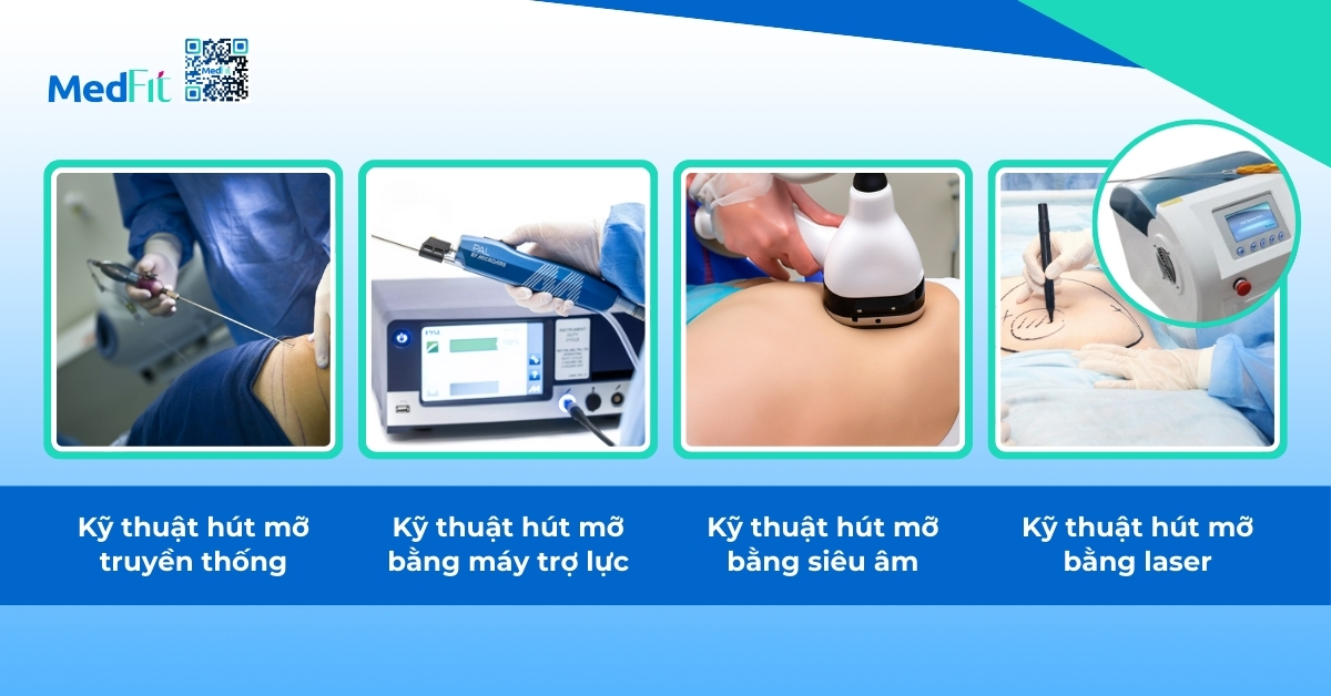 các kỹ thuật hút mỡ hiện nay