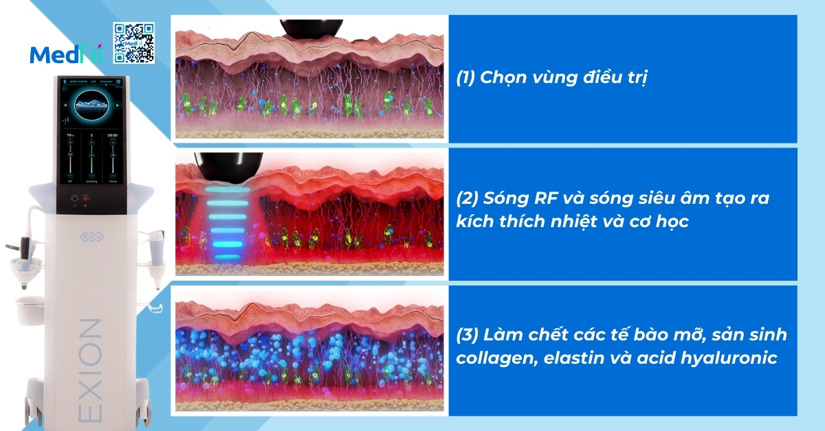 cơ chế giảm mỡ và làm săn chắc da của Exion