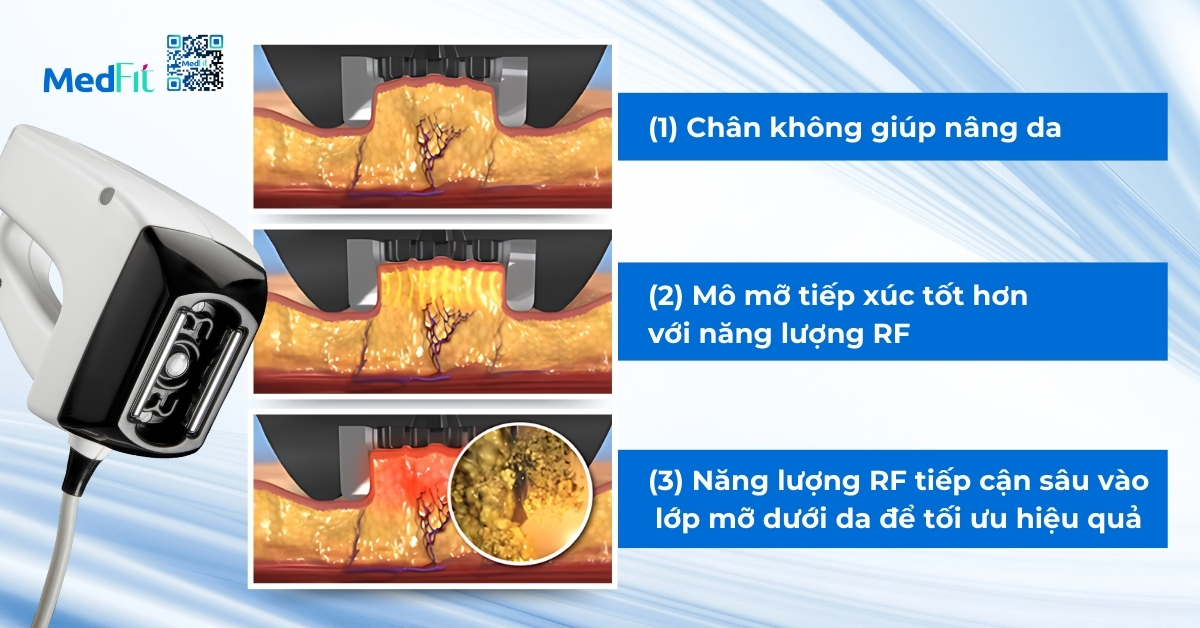 tóm tắt cơ chế hoạt động của máy contoura