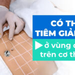Có thể tiêm giảm mỡ ở vùng da nào trên cơ thể?
