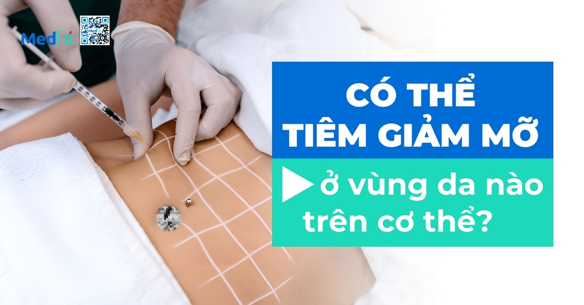 có thể tiêm giảm mỡ ở vùng da nào trên cơ thể?