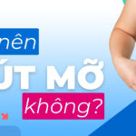 Có nên hút mỡ không?