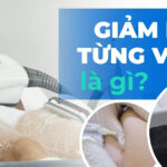 Giảm mỡ từng vùng là gì?