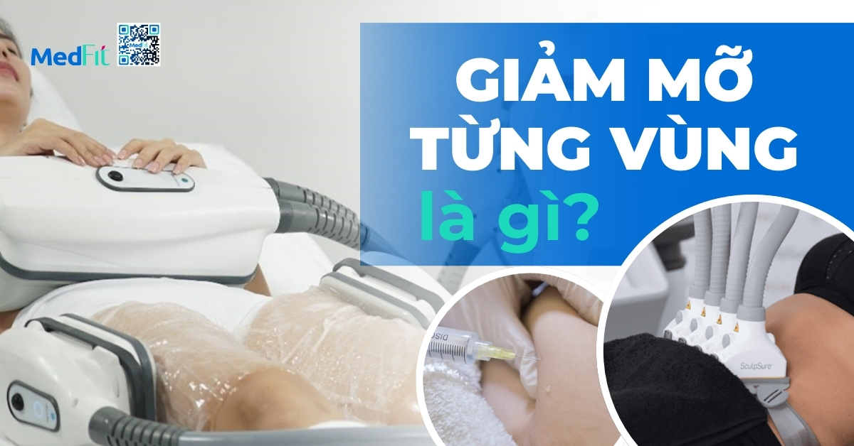 giảm mỡ từng vùng là gì?