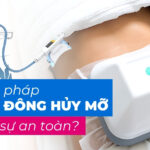 Phương pháp quang đông hủy mỡ có thực sự an toàn?