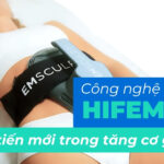 Công nghệ HIFEM là gì? Bước tiến mới trong tăng cơ giảm mỡ