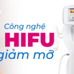 Công nghệ HIFU giảm mỡ