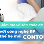 Giảm mỡ và săn chắc da với công nghệ RF thế hệ mới Contoura