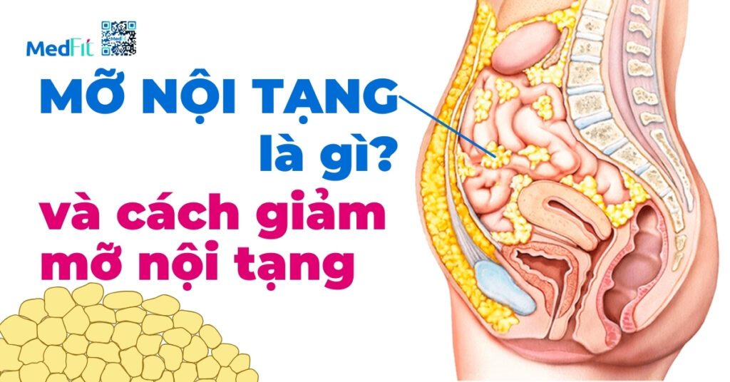 mỡ nội tạng là gì và cách giảm mỡ nội tạng