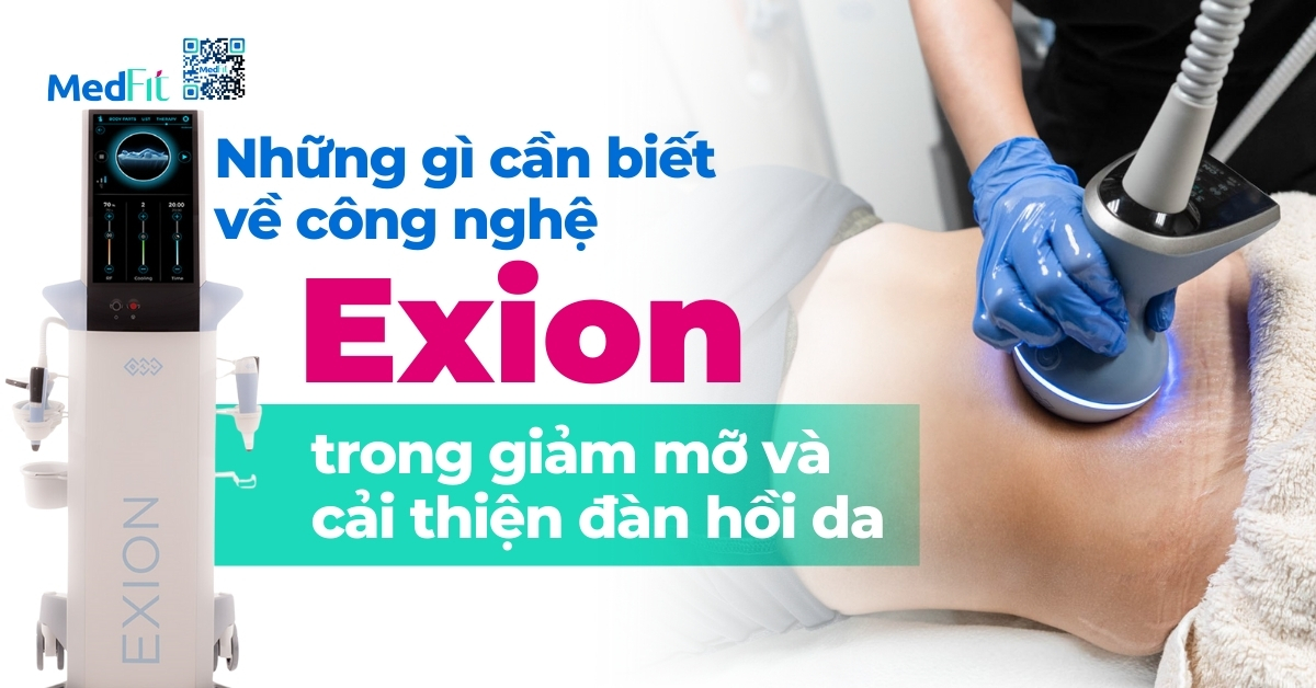 những gì cần biết về công nghệ exion trong giảm mỡ và cải thiện đàn hồi da