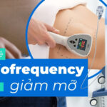 Công nghệ RF giảm mỡ