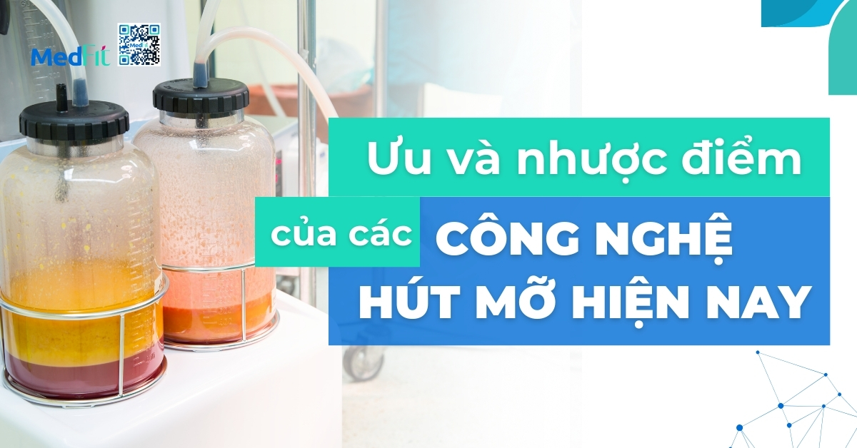 ưu điểm và nhược điểm của các công nghệ hút mỡ hiện nay