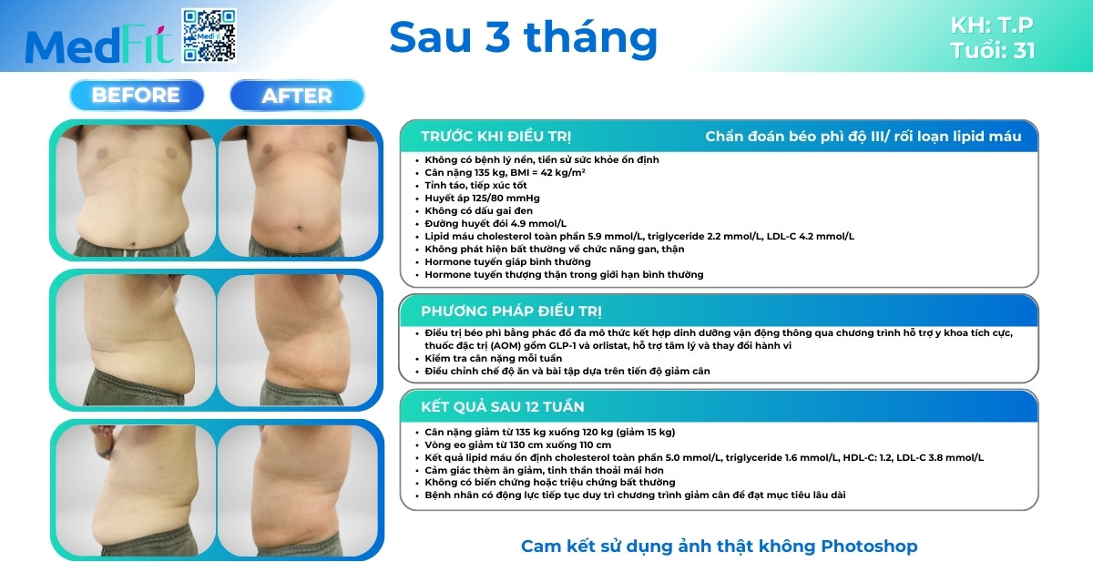 ca lâm sàng giảm cân thành công tại medfit (ca2)