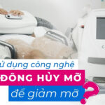 Có nên sử dụng công nghệ quang đông hủy mỡ để giảm mỡ?