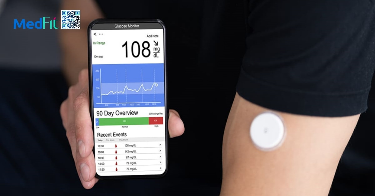 cgm cung cấp thông tin chi tiết về sự biến động của glucose trong cơ thể (hình minh họa)