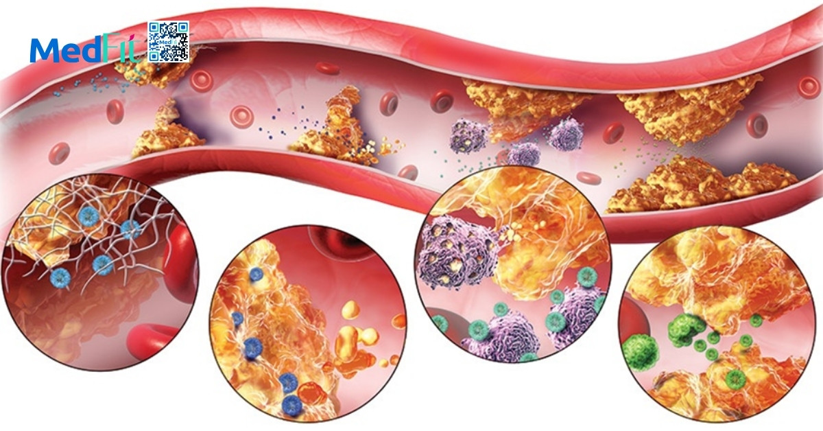 Chuyen hoa lipid