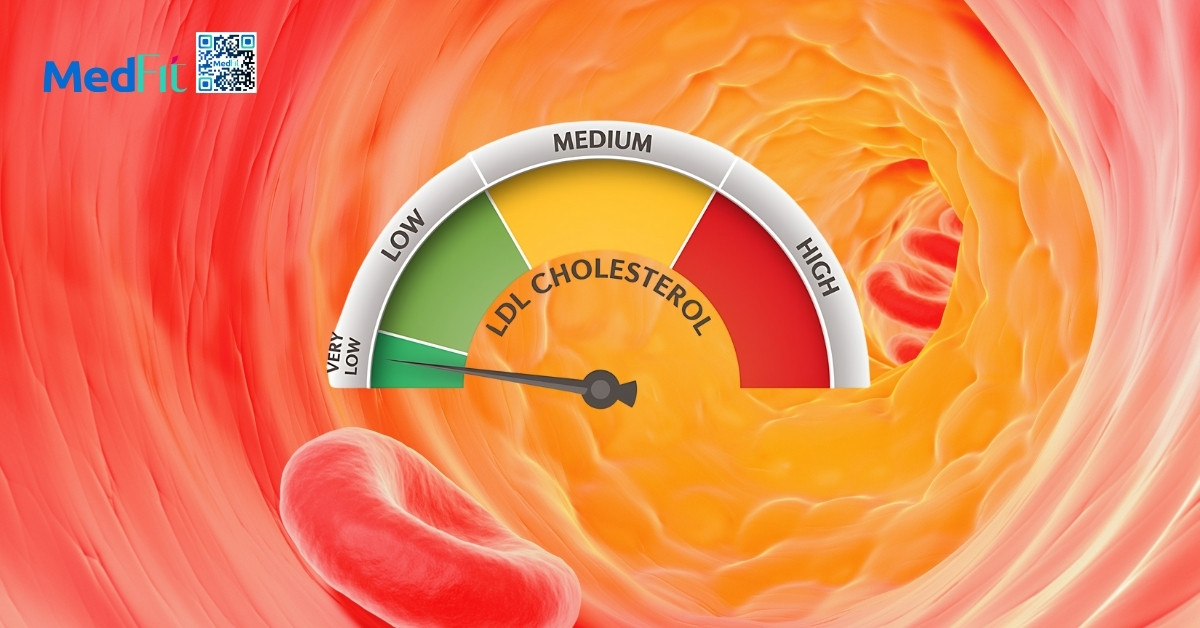 Giam cholesterol