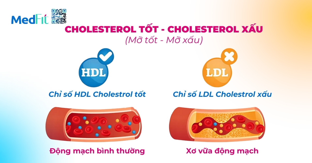 phân loại cholesterol tốt và xấu trong máu