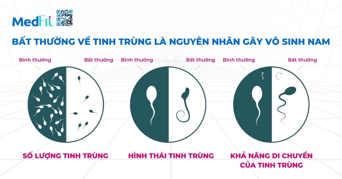 sự bất thường về tinh trùng (hình minh họa)