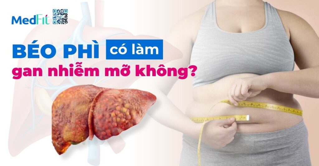 béo phì có làm gan nhiễm mỡ không?