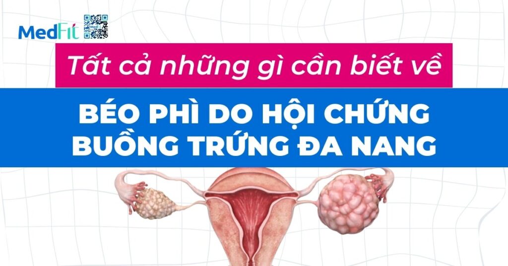 tất cả những gì cần biết về béo phì do hội chứng buồng trứng đa nang