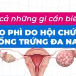 Tất cả những gì cần biết về béo phì do hội chứng buồng trứng đa nang