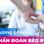 Các phương pháp chẩn đoán béo phì