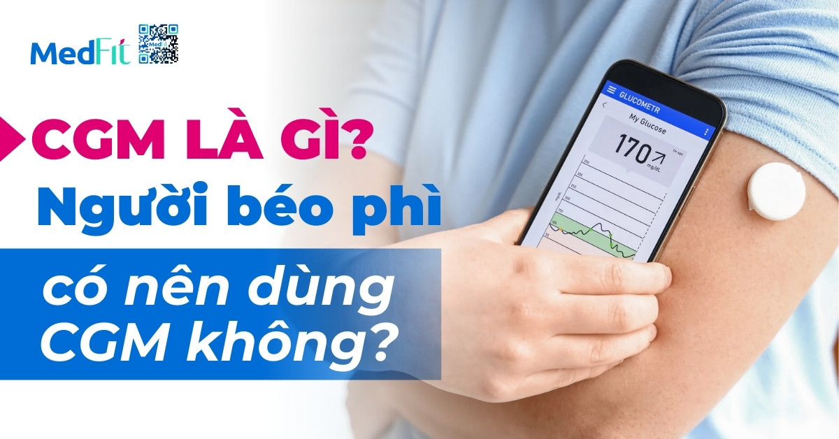 cgm là gì? người béo phì có nên dùng cgm không?