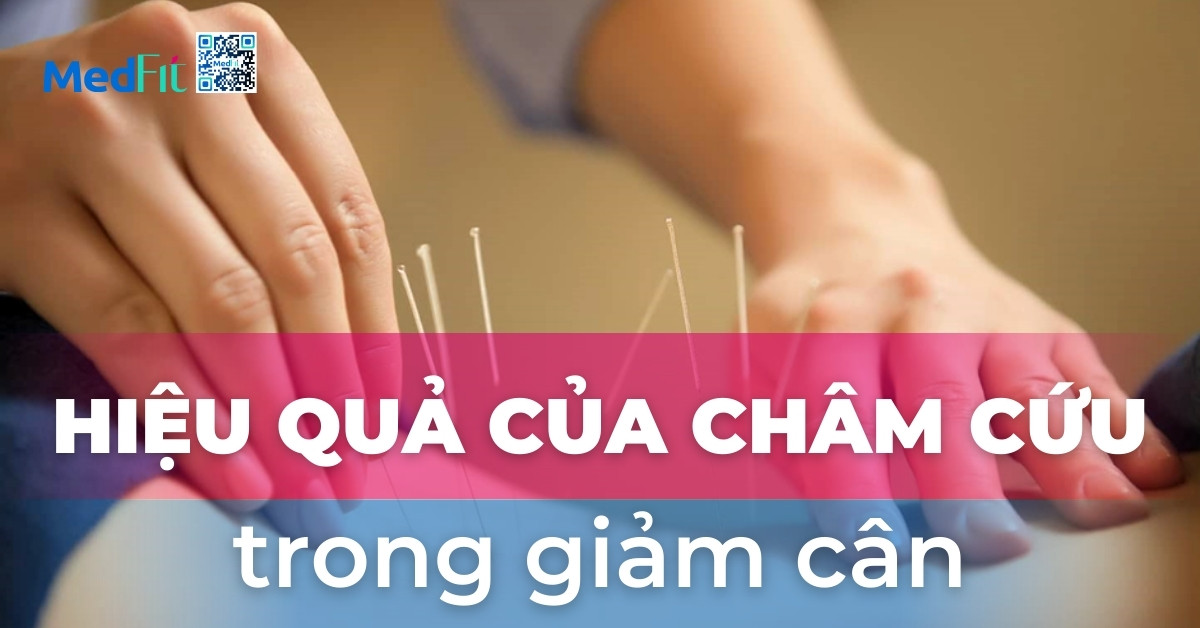 hiệu quả của châm cứu trong giảm cân