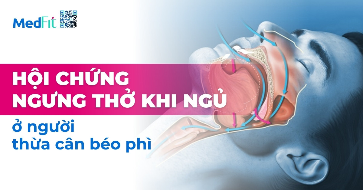 hội chứng ngưng thở khi ngủ ở người thừa cân béo phì