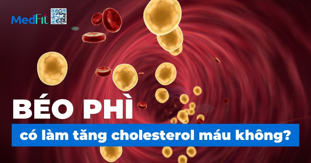 béo phì có làm tăng cholesterol máu không