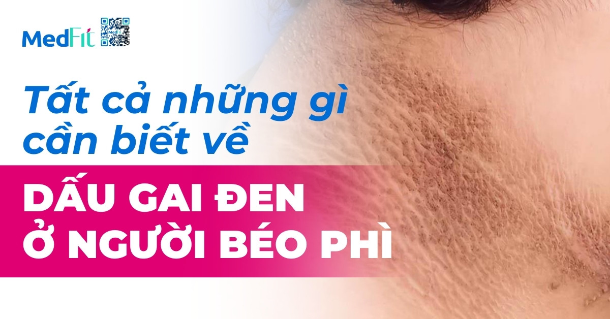 tất cả những gì cần biết về dấu gai đen ở người béo phì