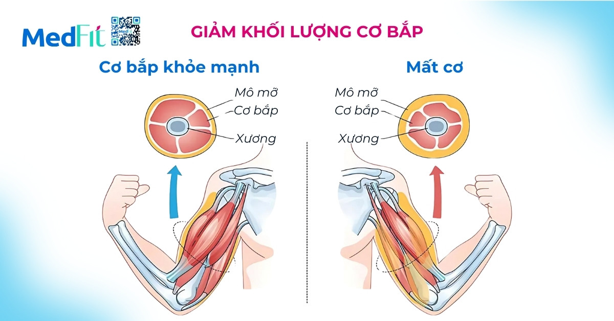 Giam khoi luong co bap