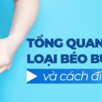 Tổng quan các loại béo bụng và cách điều trị