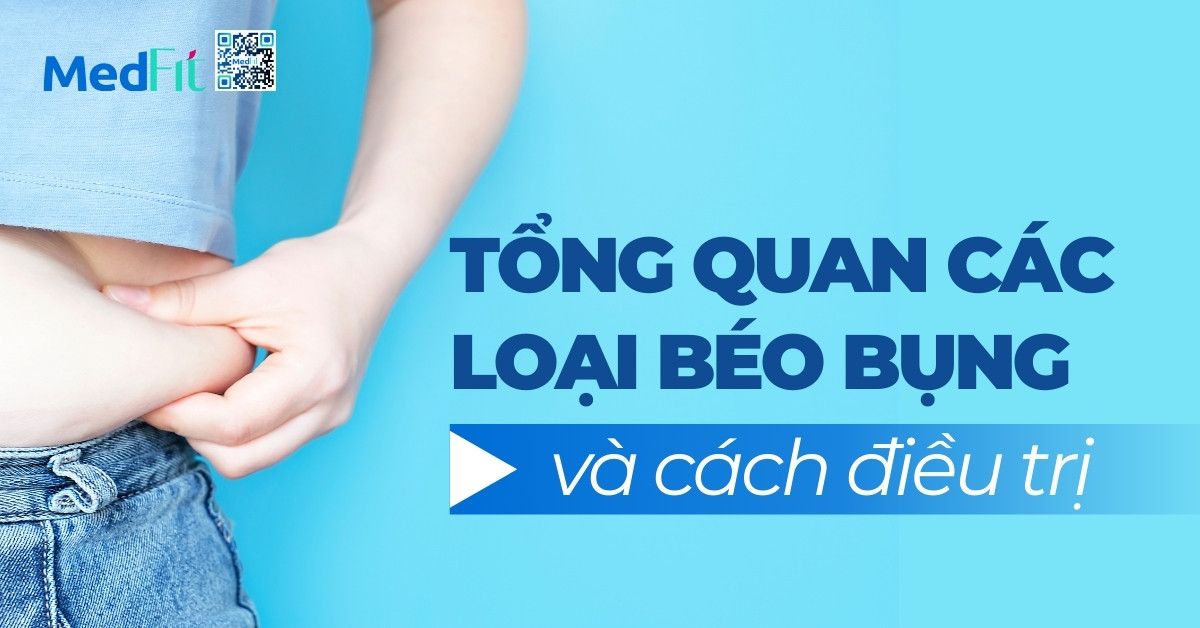 Tổng quan các loại béo bụng và cách điều trị