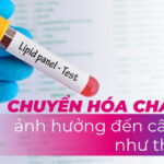 Chuyển hóa chất béo ảnh hưởng đến cân nặng như thế nào?