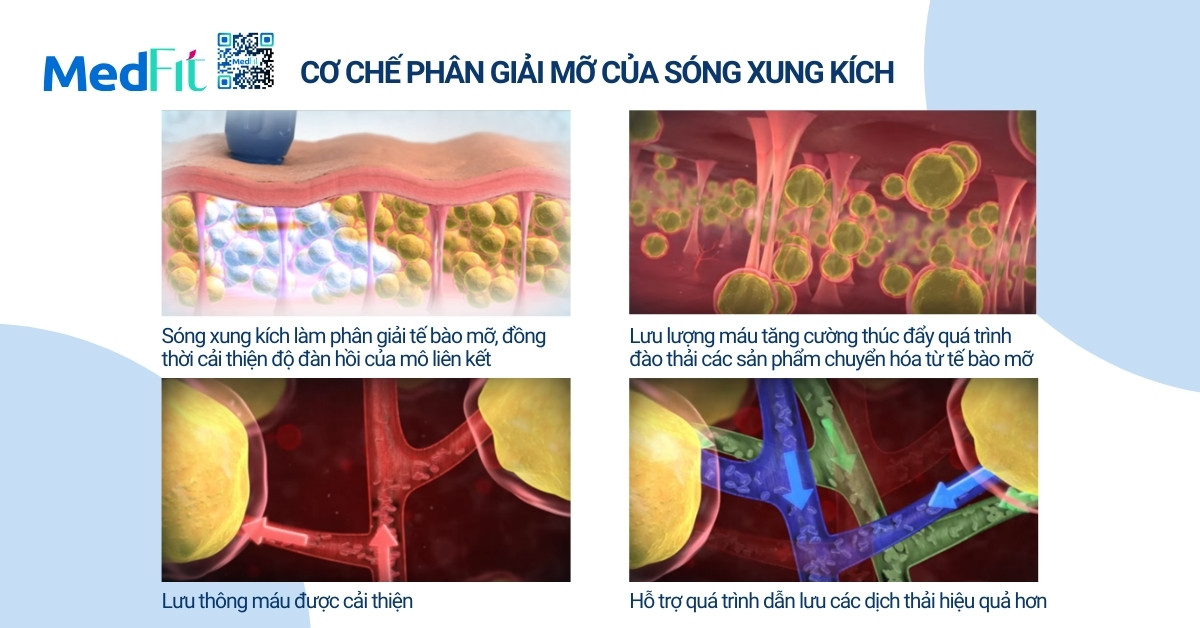 Cơ chế phân giải mỡ của sóng xung kích