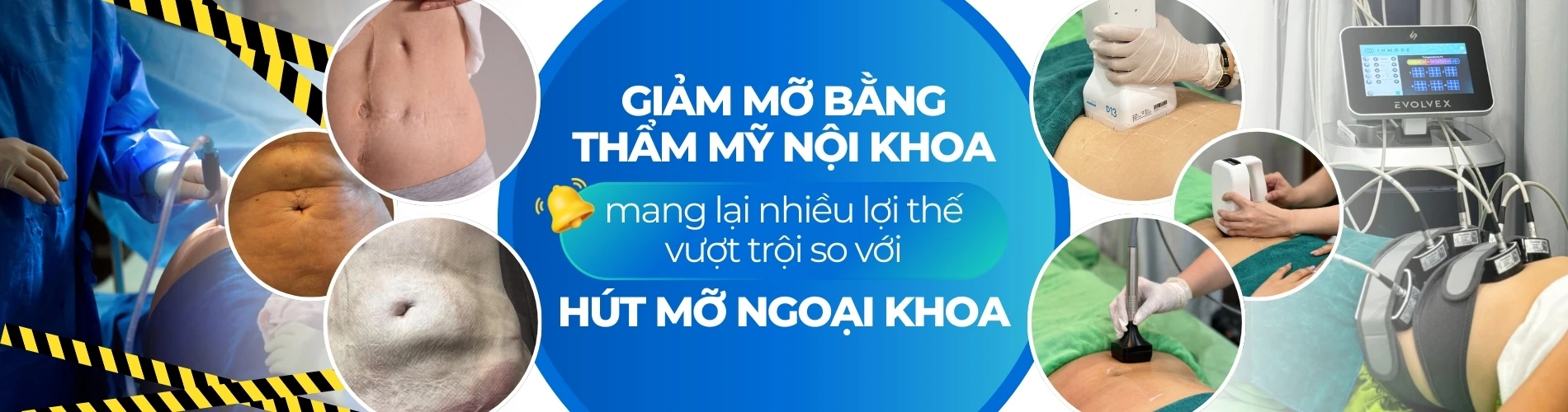 Banner lợi thế giảm mỡ bằng thẩm mỹ nội khoa