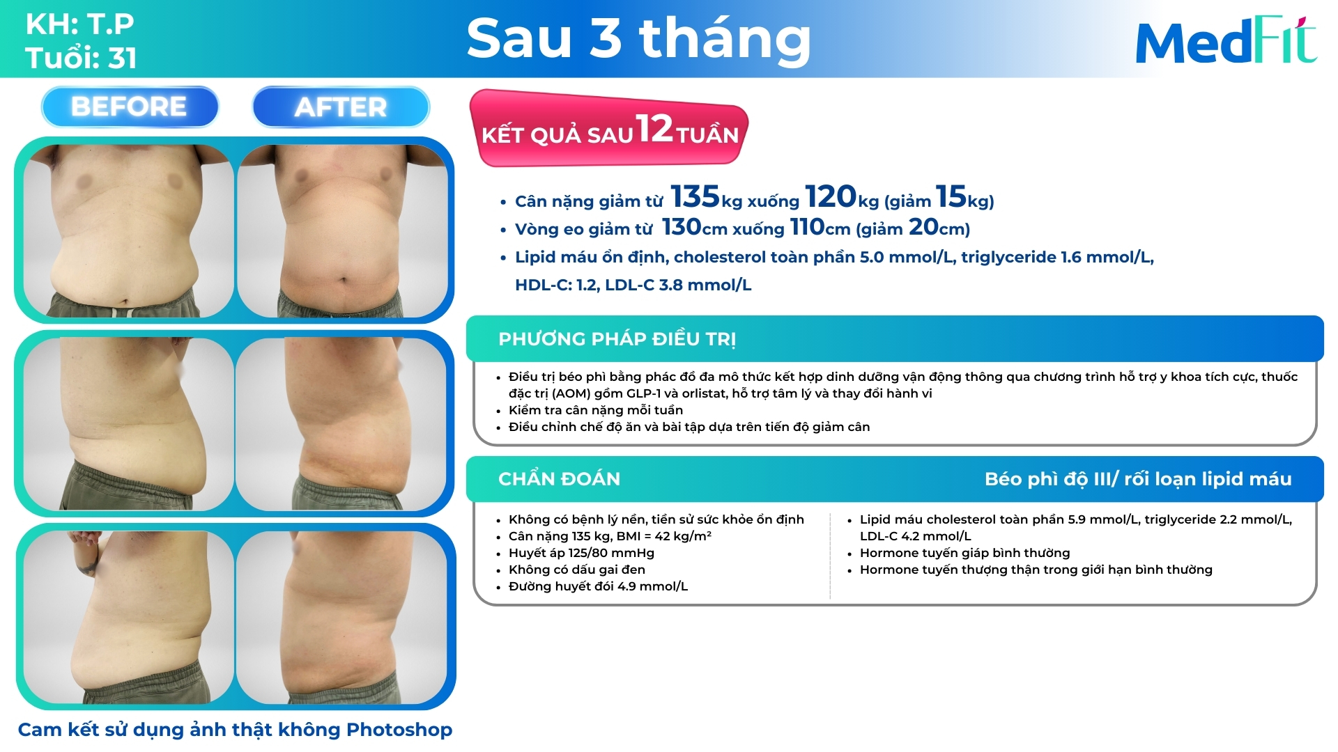 ca lâm sàng giảm cân bằng phương pháp đa mô thức tại medfit (ca nam)