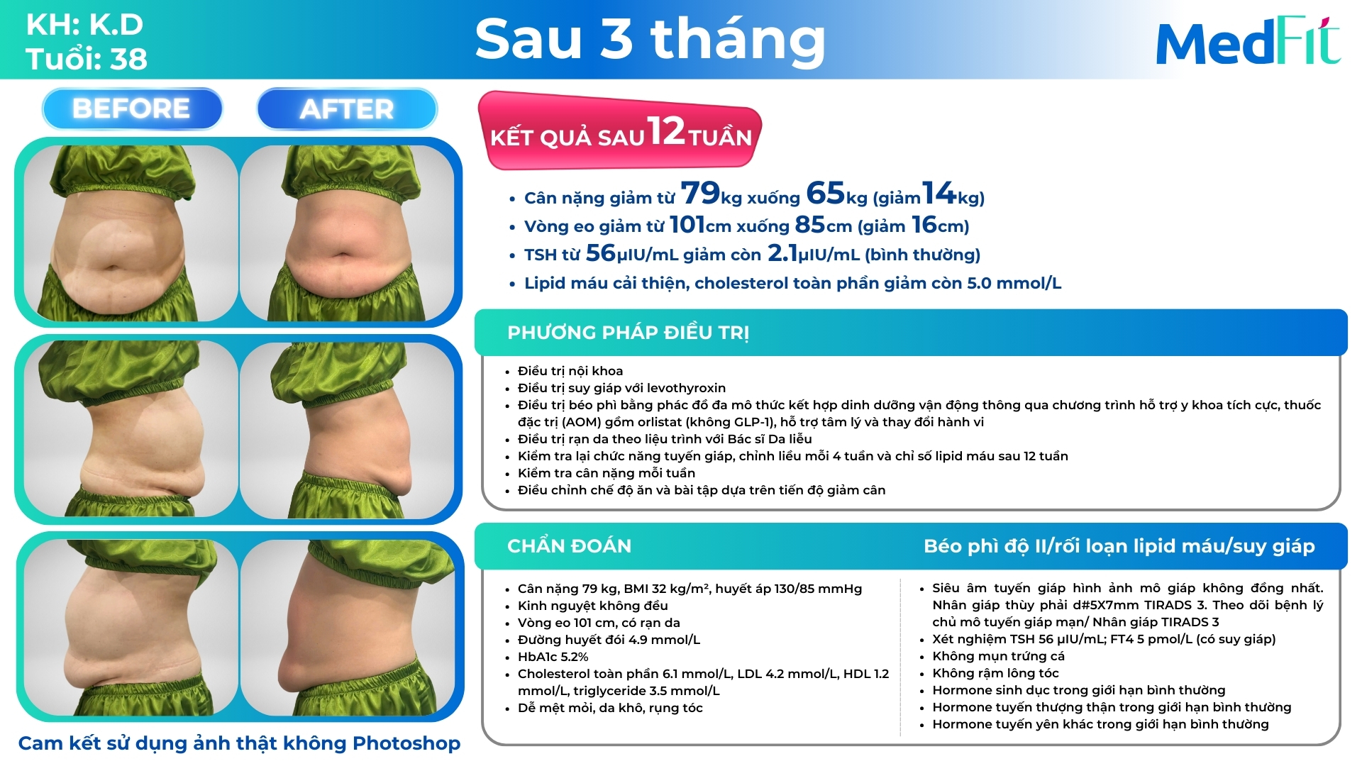 ca lâm sàng giảm cân bằng phương pháp đa mô thức tại medfit (ca nữ)