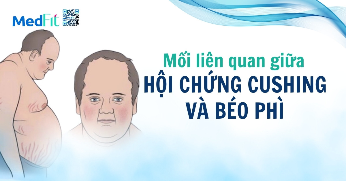 mối liên hệ giữa hội chứng cushing và béo phì