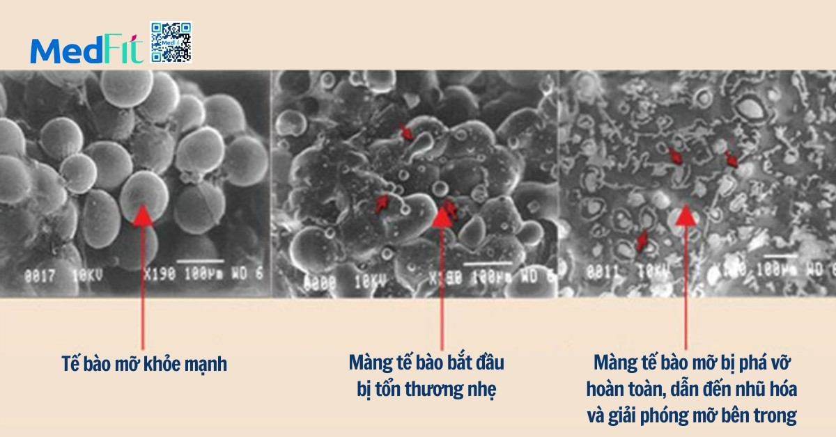 hình ảnh kính hiển vi điện tử quét (SEM) của tế bào mỡ sau khi chiếu ánh sáng đỏ