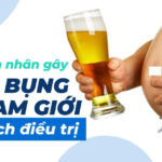 Nguyên nhân gây béo bụng ở nam giới và cách điều trị