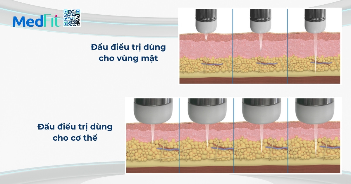 các đầu điều trị của máy cfu èlife