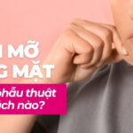 Giảm mỡ vùng mặt không phẫu thuật bằng cách nào?