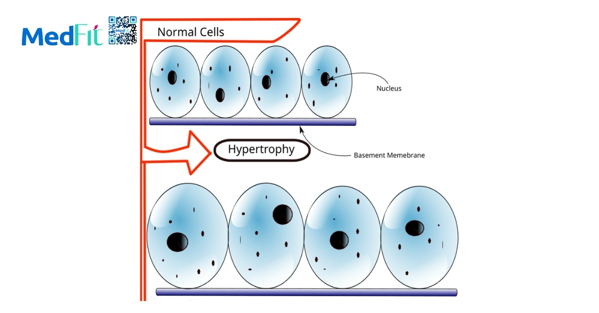 hình minh họa hypertrophy (tăng trưởng cơ)