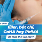 Nên chọn filler, bột chỉ, CaHA hay PMMA để tăng thể tích mặt?