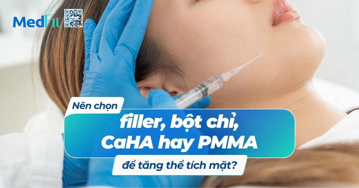 nên chọn filler, bột chỉ, caha hay pmma để tăng thể tích mặt