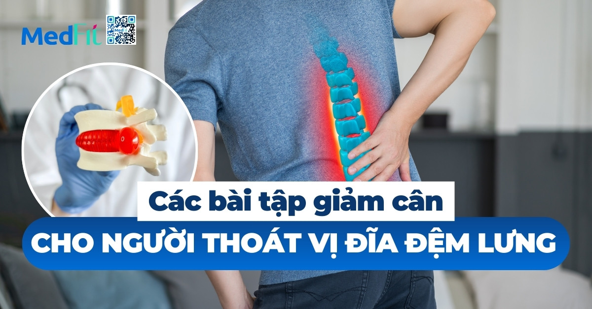 các bài tập giảm cân cho người thoát vị đĩa đệm lưng