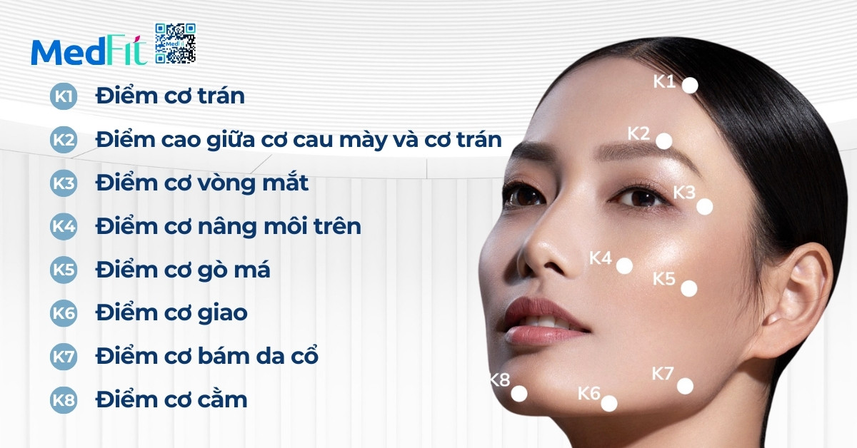 hình minh họa kỹ thuật tiêm k15+, các điểm được xác định tương tự với nửa mặt còn lại